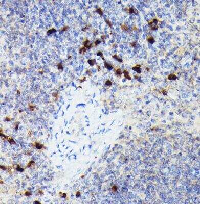 Immunohistochemistry-Paraffin: Cathepsin G Antibody - Azide and BSA Free [NBP2-92789]
