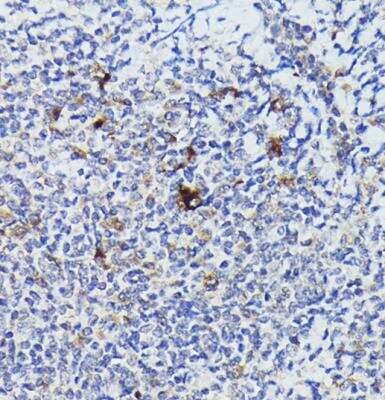 Immunohistochemistry-Paraffin: Cathepsin G Antibody - Azide and BSA Free [NBP2-92789]