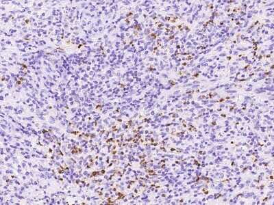 Immunohistochemistry-Paraffin: Cathepsin G Antibody [NBP2-97363]