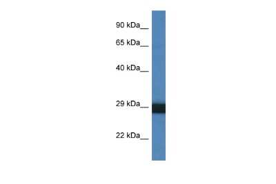 Western Blot: Cathepsin G Antibody [NBP2-87126]