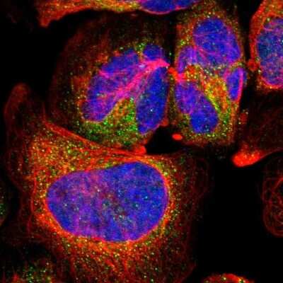 Immunocytochemistry/ Immunofluorescence: Cathepsin H Antibody [NBP1-90273]