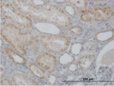 Immunohistochemistry-Paraffin: Cathepsin H Antibody [H00001512-B01P]