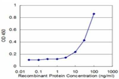 ELISA: Cathepsin K Antibody (1B11) [H00001513-M03]