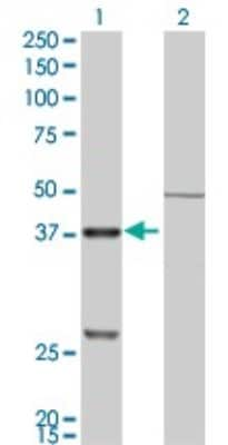 Western Blot: Cathepsin K Antibody (2F1) [H00001513-M01]