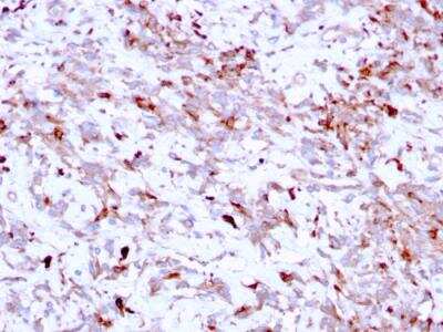 Immunohistochemistry-Paraffin: Cathepsin K Antibody (CTSK/2791) - Azide and BSA Free [NBP2-79889]