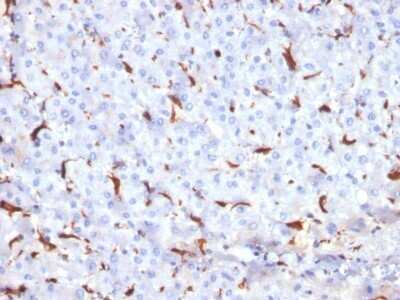 Immunohistochemistry-Paraffin: Cathepsin K Antibody (CTSK/2791) - Azide and BSA Free [NBP2-79889]