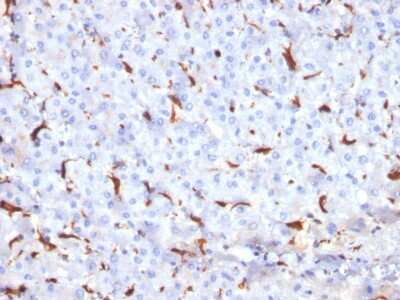 Immunohistochemistry-Paraffin: Cathepsin K Antibody (CTSK/2791) [NBP2-79754]