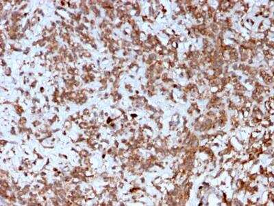 Immunohistochemistry-Paraffin: Cathepsin K Antibody (CTSK/2792) - Azide and BSA Free [NBP2-79890]