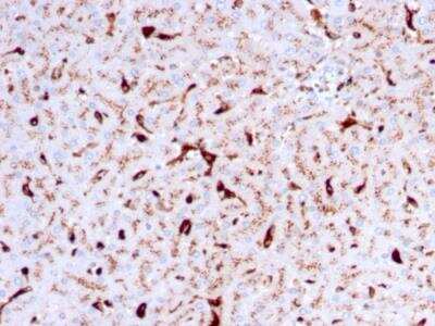 Immunohistochemistry-Paraffin: Cathepsin K Antibody (CTSK/2792) - Azide and BSA Free [NBP2-79890]