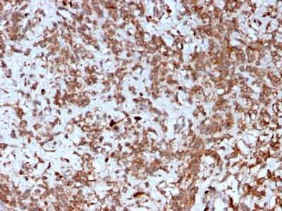 Immunohistochemistry-Paraffin: Cathepsin K Antibody (CTSK/2792) [NBP2-79755]
