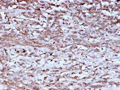 Immunohistochemistry-Paraffin: Cathepsin K Antibody (CTSK/2793) - Azide and BSA Free [NBP2-79900]