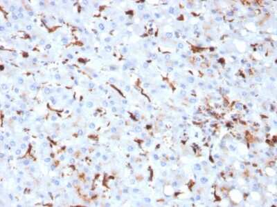 Immunohistochemistry-Paraffin: Cathepsin K Antibody (CTSK/2793) [NBP2-79765]