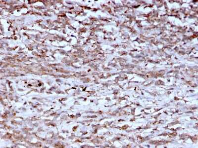 Immunohistochemistry-Paraffin: Cathepsin K Antibody (CTSK/2793) [NBP2-79765]