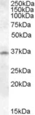 Western Blot: Cathepsin K Antibody [NB100-94902]