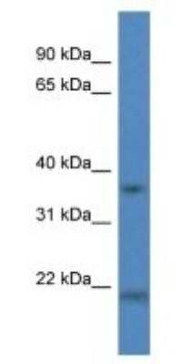 Western Blot: Cathepsin K Antibody [NBP1-79878]