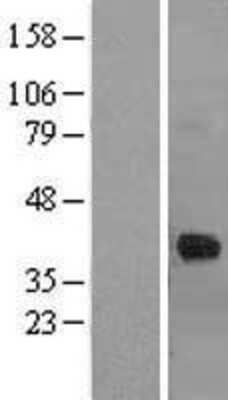 Western Blot: Cathepsin K Overexpression Lysate [NBL1-09593]