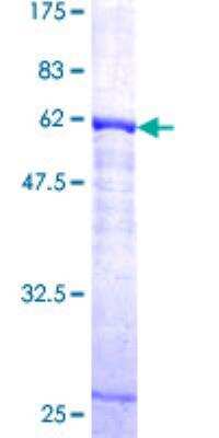 SDS-PAGE: Recombinant Human Cathepsin K GST (N-Term) Protein [H00001513-P01]