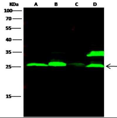 Western Blot: Cathepsin L Antibody (221) [NBP2-89528]