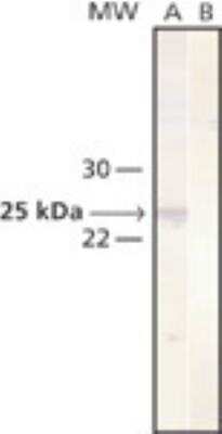 Western Blot: Cathepsin L Antibody (33/2) [NB100-1775]