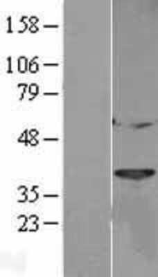 Western Blot: Cathepsin L Overexpression Lysate [NBL1-09594]