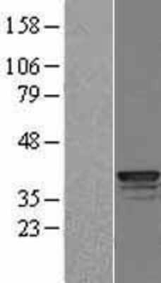 Western Blot: Cathepsin L Overexpression Lysate [NBL1-09595]