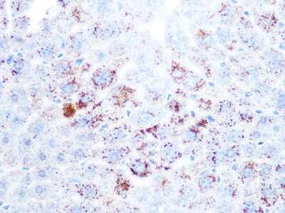 Immunohistochemistry-Paraffin: Cathepsin L/V/K/H Antibody (2Q10F10) [NBP3-16524]