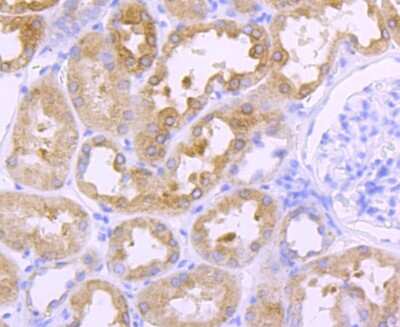 Immunohistochemistry-Paraffin: Cathepsin L/V/K/H Antibody (JM10-78) [NBP2-67216]