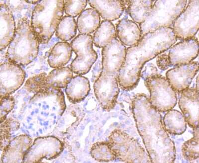 Immunohistochemistry-Paraffin: Cathepsin L/V/K/H Antibody (JM10-78) [NBP2-67216]