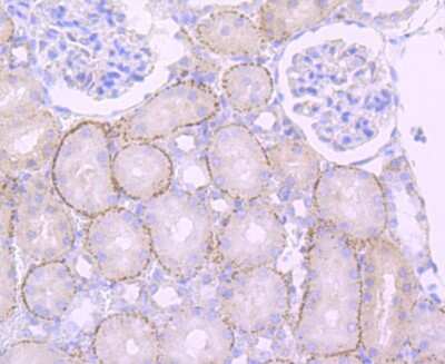 Immunohistochemistry-Paraffin: Cathepsin L/V/K/H Antibody (JM10-78) [NBP2-67216]