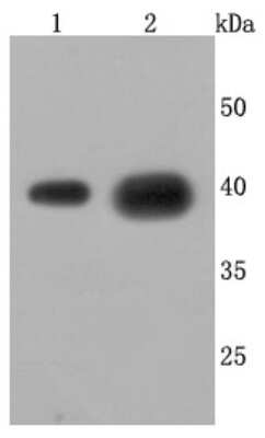 Western Blot: Cathepsin L/V/K/H Antibody (JM10-78) [NBP2-67216]