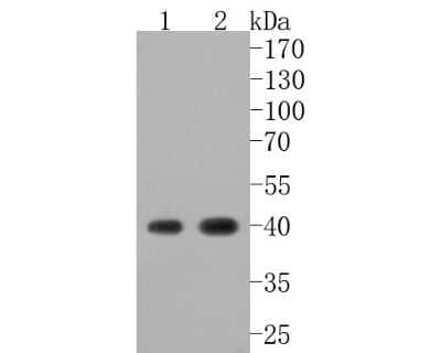 Western Blot: Cathepsin L/V/K/H Antibody (JM10-78) [NBP2-67216]