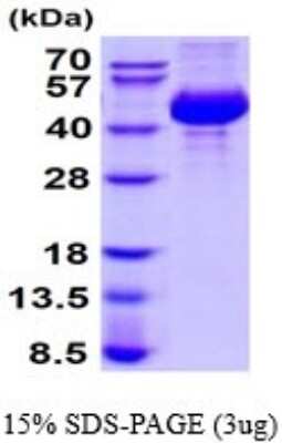 SDS-PAGE: Recombinant Mouse Cathepsin L1 His Protein [NBP2-52318]
