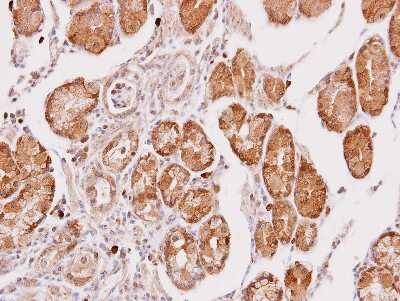 Immunohistochemistry-Paraffin: Cathepsin O Antibody [NBP2-15726]