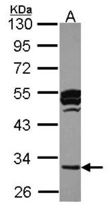 Western Blot: Cathepsin O Antibody [NBP2-15726]