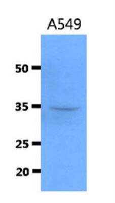 Western Blot: Cathepsin S Antibody (1F9)BSA Free [NBP2-42634]