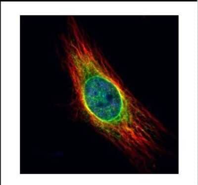 Immunocytochemistry/ Immunofluorescence: Cathepsin S Antibody [NBP2-15727]