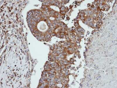 Immunohistochemistry-Paraffin: Cathepsin S Antibody [NBP1-31434]