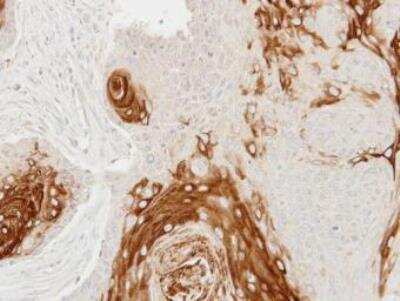 Immunohistochemistry-Paraffin: Cathepsin S Antibody [NBP2-15727]