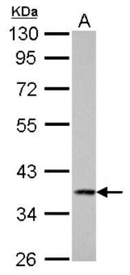 Western Blot: Cathepsin S Antibody [NBP1-31434]