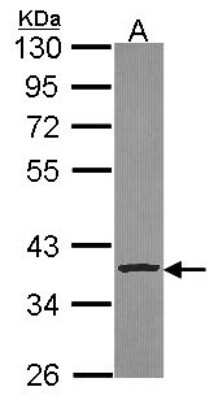 Western Blot: Cathepsin S Antibody [NBP2-15727]