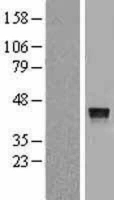 Western Blot: Cathepsin V Overexpression Lysate [NBL1-09596]