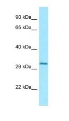 Western Blot: Cathepsin W Antibody [NBP1-98601]