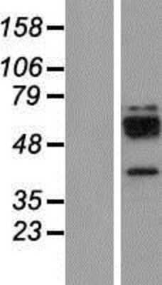 Western Blot: Cathepsin W Overexpression Lysate [NBP2-10971]