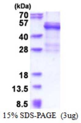 SDS-PAGE: Recombinant Human Cathepsin W His Protein [NBP2-51517]