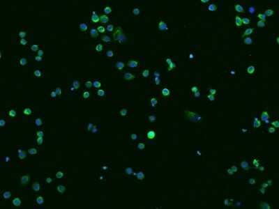 Immunocytochemistry/ Immunofluorescence: Cathepsin X/Z/P Antibody (009) [NBP2-90411]