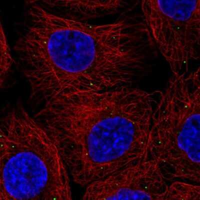 Immunocytochemistry/ Immunofluorescence: Cathepsin X/Z/P Antibody [NBP2-38614]