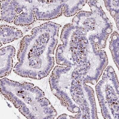 Immunohistochemistry: Cathepsin X/Z/P Antibody [NBP2-38703]