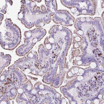 Immunohistochemistry-Paraffin: Cathepsin X/Z/P Antibody [NBP2-38614]