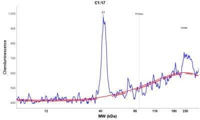 Simple Western: Cathepsin X/Z/P Antibody [NBP2-38614]