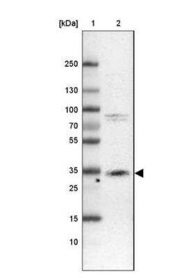 Western Blot: Cathepsin X/Z/P Antibody [NBP2-38614]